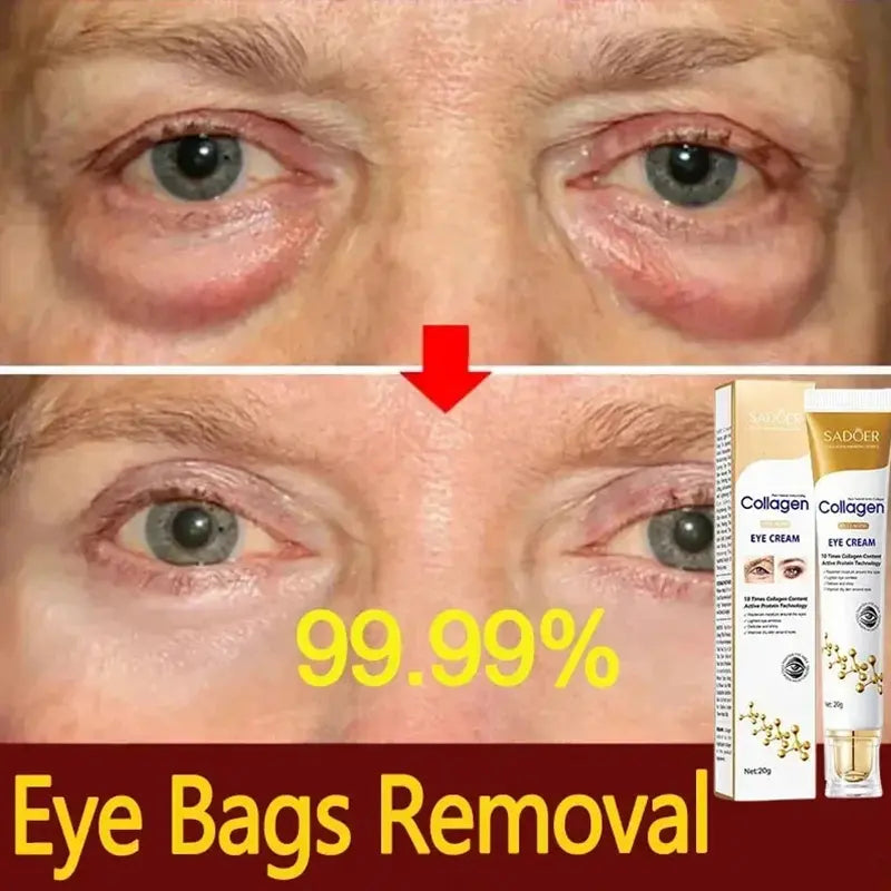 Instant Eye Bag Removal Cream Collagen Anti-Wrinkle Fade Fine Lines Firming Skin anti Dark Circle Puffiness Brighten Eye Care