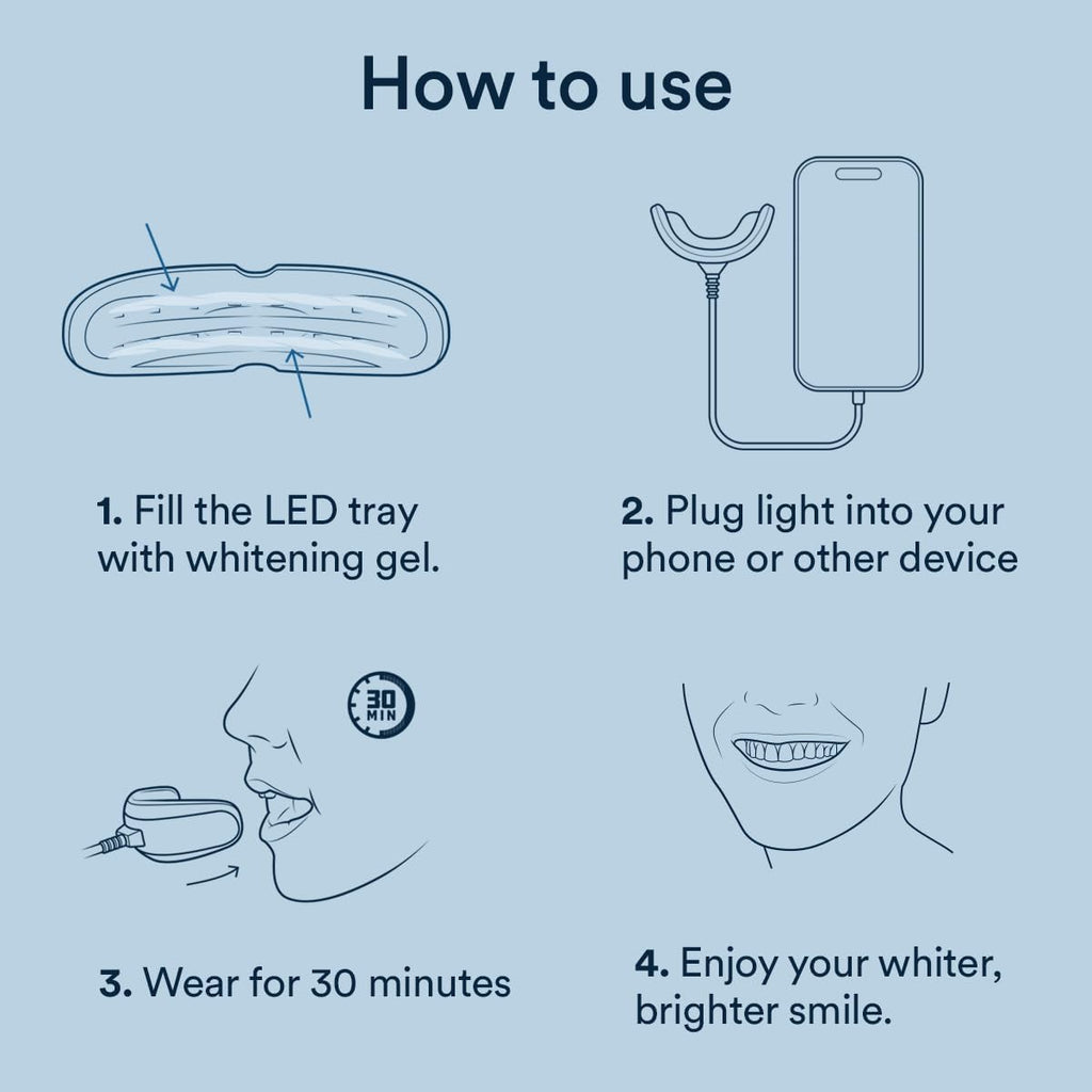 Auraglow Plug-in LED Teeth Whitening Kit – Wired Light Device – 35% Carbamide Peroxide Gel – 12 Treatments – at-Home Tooth Whitening System – Enamel-Safe at-Home Whitening for Coffee & Tea Stains