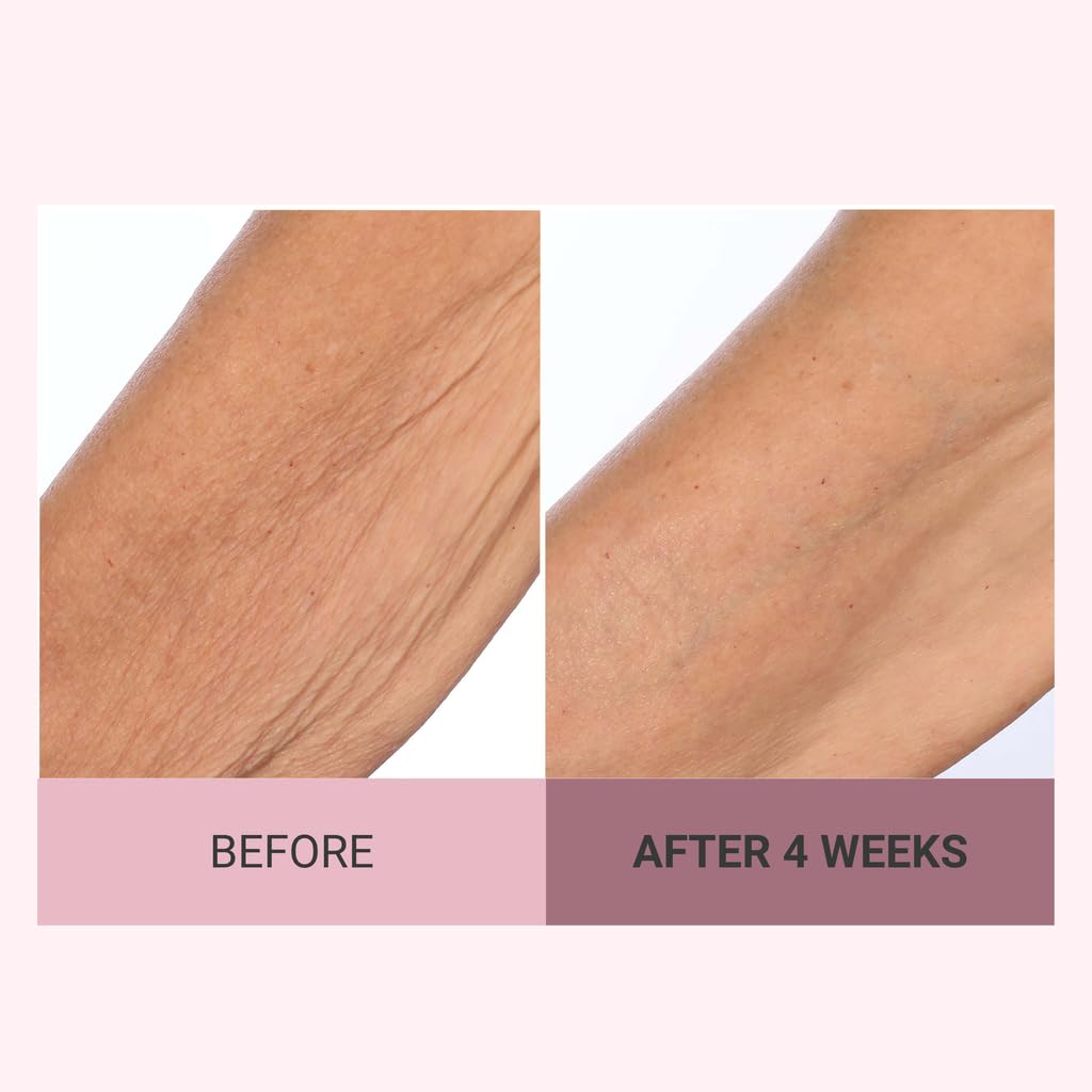 Consult Beaute Champagne Lift Hydrating Firming Body Cream with Pink Pepperslim for Crepey Skin Moisturizer Tightens, Tones & Hydrates Dry Skin on Arms & Legs - 8 oz.
