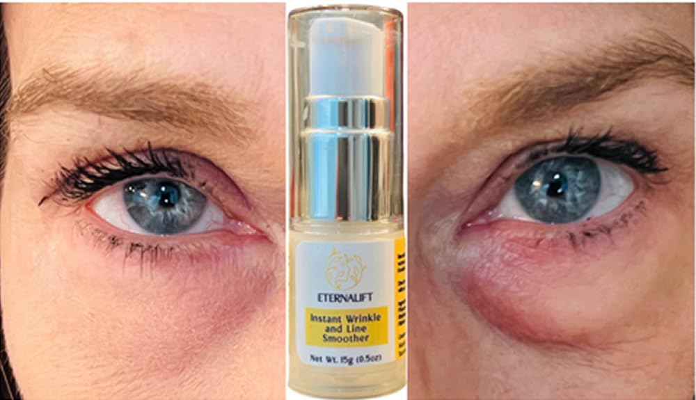 Instant Eye Bag Puffiness And Wrinkle Remover Cream For Women And Men Made In The USA! Cruelty-Free Larger Size