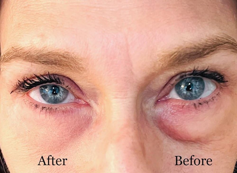 Instant Eye Bag Puffiness And Wrinkle Remover Cream For Women And Men Made In The USA! Cruelty-Free Larger Size