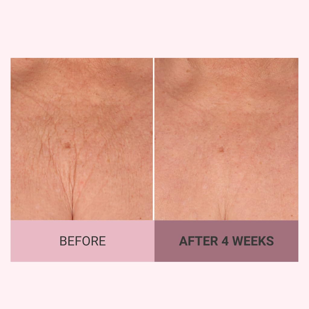 Consult Beaute Champagne Lift Hydrating Firming Body Cream with Pink Pepperslim for Crepey Skin Moisturizer Tightens, Tones & Hydrates Dry Skin on Arms & Legs - 8 oz.
