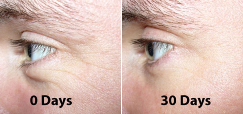 DNA Code®-No Needle Alternative-Pure Argireline Peptides Winkle Reduce Cream-Hyaluronic Acid+ Matrixyl 3000