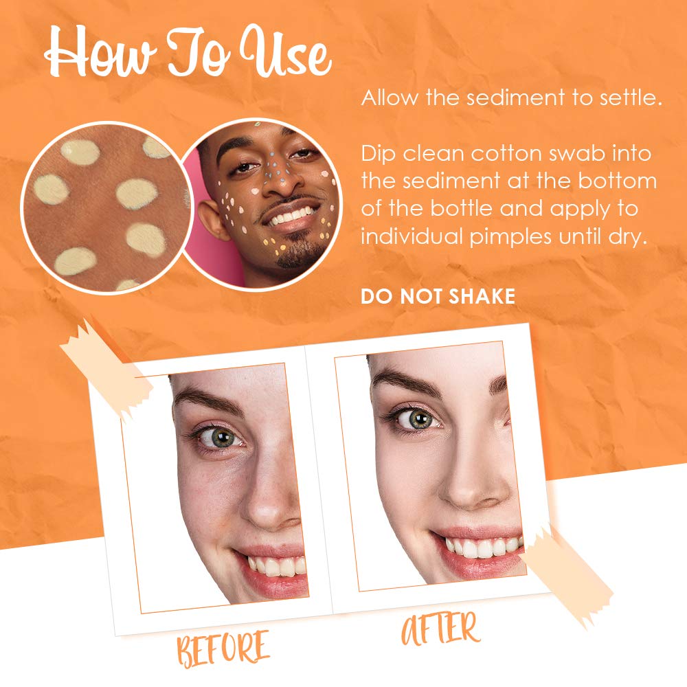 Bye Bye Blemish Dark Spot Lotion Vitamin C | Assists with Drying Blemishes and Brightening Skin | Fast Acting Solution | 1 Fl Oz