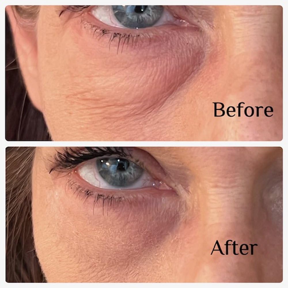 Instant Eye Bag Puffiness And Wrinkle Remover Cream For Women And Men Made In The USA! Cruelty-Free Larger Size