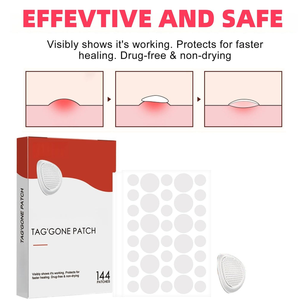 288PCS T-ag'gone Patch,Spot Stickers,Nano Patch for Face and Skin,Face Care P/atch,Acne Pimple Patches,Skin T-ag Remover Patches,M-ole Remover,Skin Ta-g P/atches,Skin Ta-g R/emover,W-art Treatment