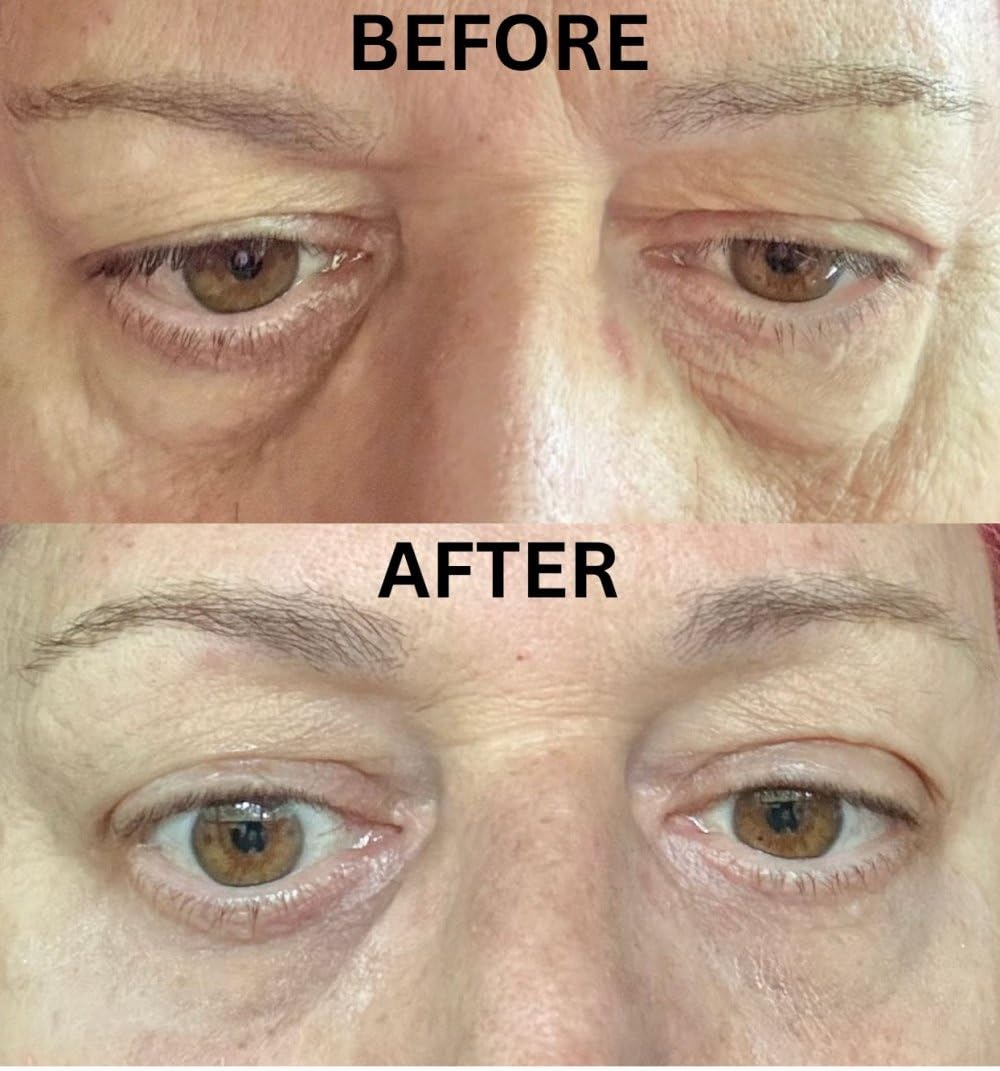 Instant Eye Bag Puffiness And Wrinkle Remover Cream For Women And Men Made In The USA! Cruelty-Free Larger Size