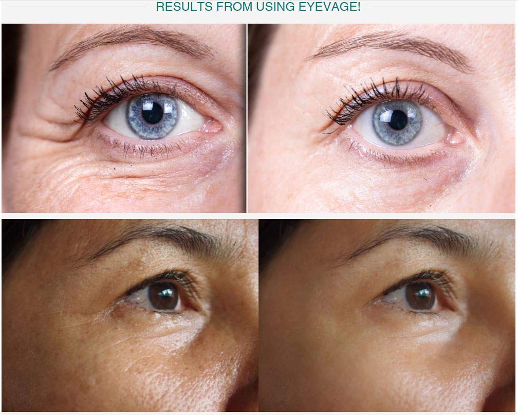 Solvaderm Eyevage Anti-Aging Eye Cream – Reduces Dark Circles, Puffiness, Fine Lines & Wrinkles – Hydrating & Firming Under Eye Treatment for Bags, Crow’s Feet – Dermatologist-Recommended Skincare