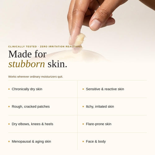 Blossom Essentials Honey Salve - Organic Manuka Honey Hydration Repair - Eczema Relief for Dry, Itchy, Sensitive Skin - Soothing Moisturizer & Balm for Kids, Adults - USA - 4oz