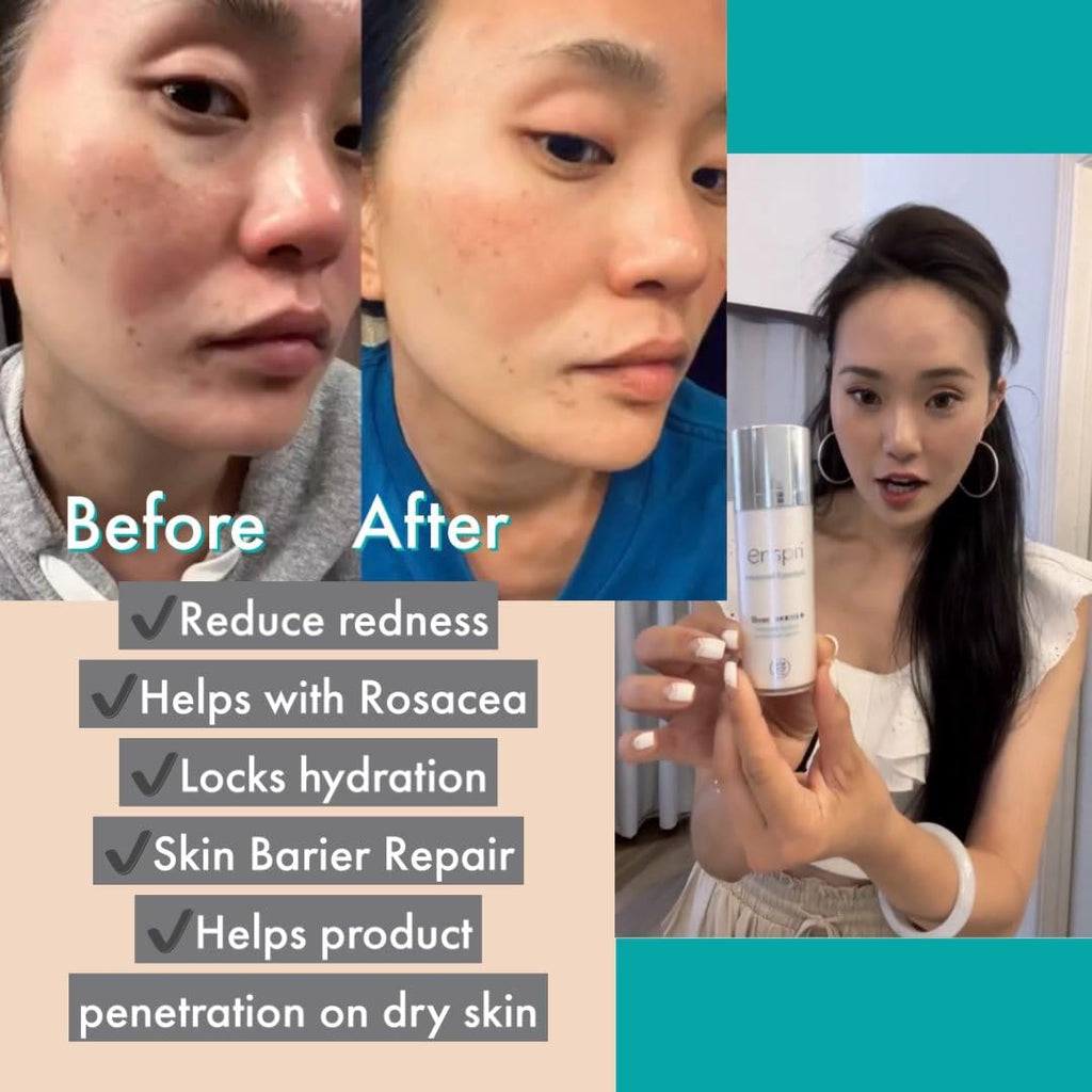 Enspri Sheer Ceramide Moisture-locking Protective Serum increased Elasticity, firmness, skin resurfacing, and reduced wrinkles
