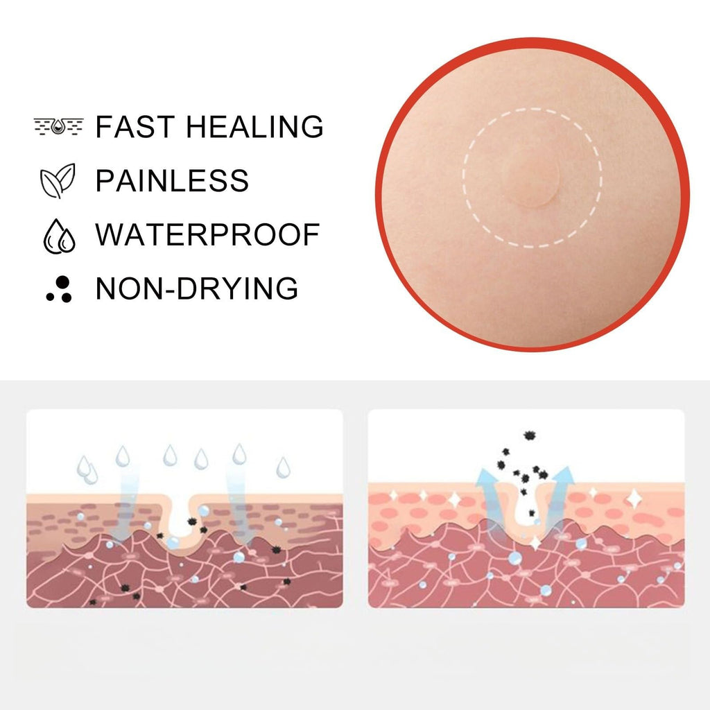 288PCS T-ag'gone Patch,Spot Stickers,Nano Patch for Face and Skin,Face Care P/atch,Acne Pimple Patches,Skin T-ag Remover Patches,M-ole Remover,Skin Ta-g P/atches,Skin Ta-g R/emover,W-art Treatment