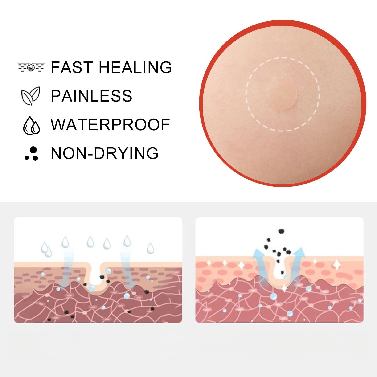 288PCS T-ag'gone Patch,Spot Stickers,Nano Patch for Face and Skin,Face Care P/atch,Acne Pimple Patches,Skin T-ag Remover Patches,M-ole Remover,Skin Ta-g P/atches,Skin Ta-g R/emover,W-art Treatment