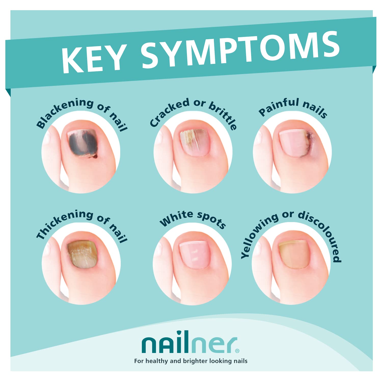 NAILNER REPAIR BRUSH 5ML by YOUMEDICAL by Nailner