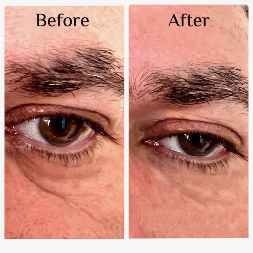 Instant Eye Bag Puffiness And Wrinkle Remover Cream For Women And Men Made In The USA! Cruelty-Free Larger Size