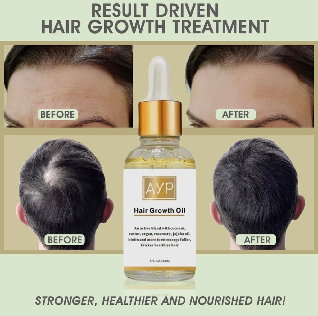 Hair Growth Serum with Organic Oils, Rosemary, Castor, Argan, Avocado, Coconut & Jojoba, Biotin for Thickening & Loss Prevention