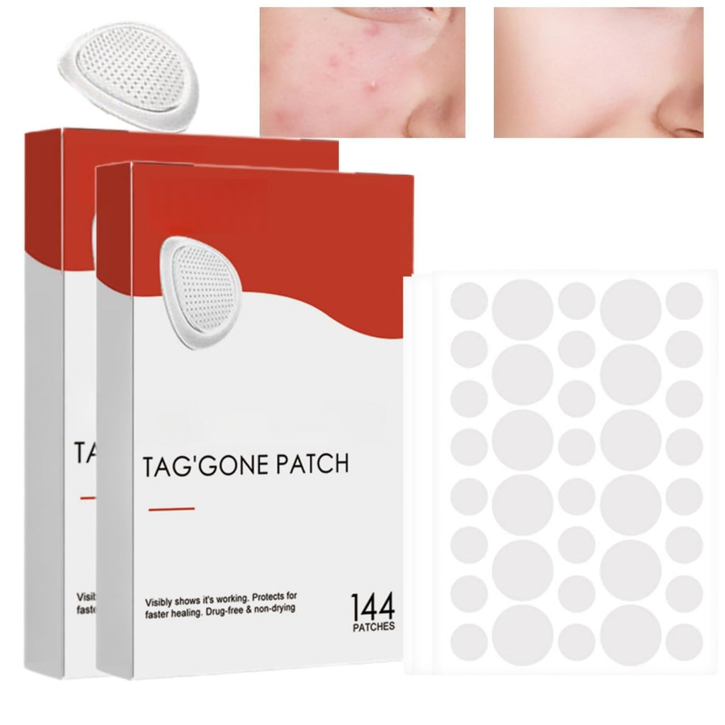 288PCS T-ag'gone Patch,Spot Stickers,Nano Patch for Face and Skin,Face Care P/atch,Acne Pimple Patches,Skin T-ag Remover Patches,M-ole Remover,Skin Ta-g P/atches,Skin Ta-g R/emover,W-art Treatment