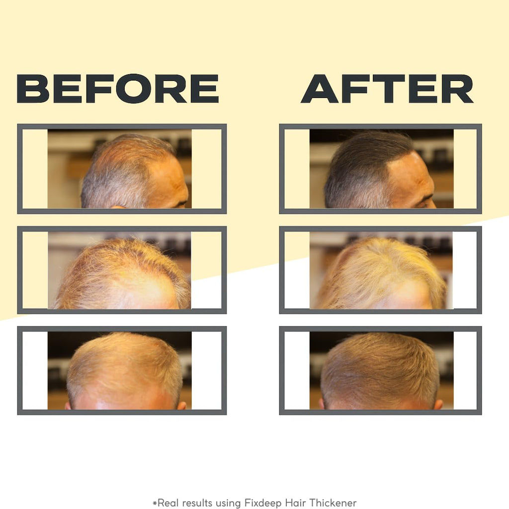 FIXDEEP Hair Thickener | New Waterproof Formula - Natural & Fuller Looking Hair in 30 sec - 14g - Fibers for Thinning, Bald Spots & Graying Roots (Dark Brown)