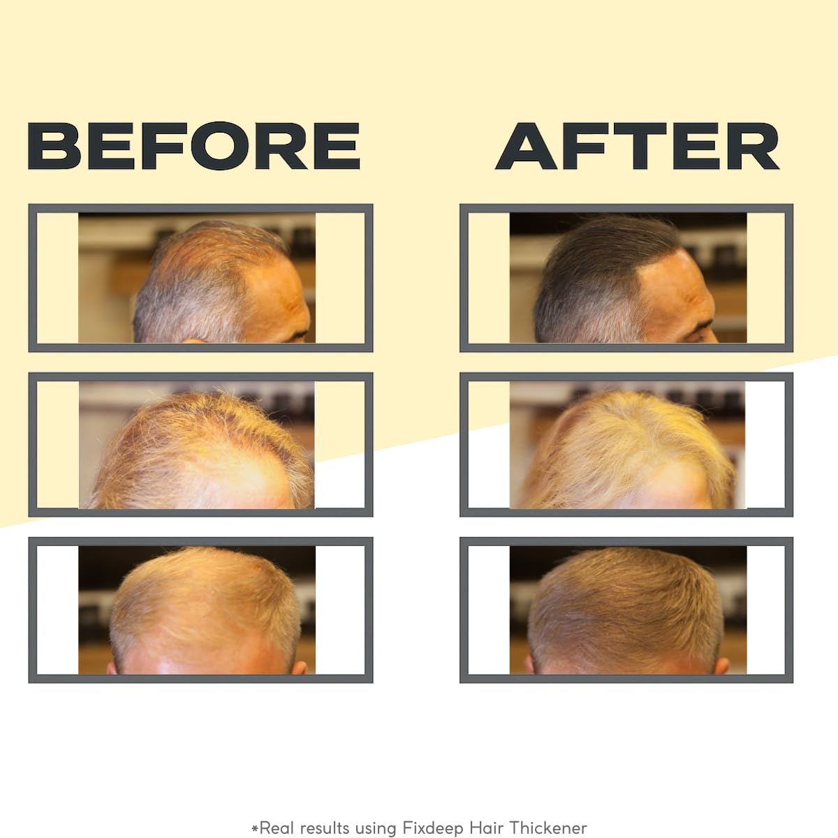 FIXDEEP Hair Thickener | New Waterproof Formula - Natural & Fuller Appearance in 30 Seconds - 14g - Hair Fibers for Thinning Hair, Bald Spots & Graying Roots (Medium Brown)