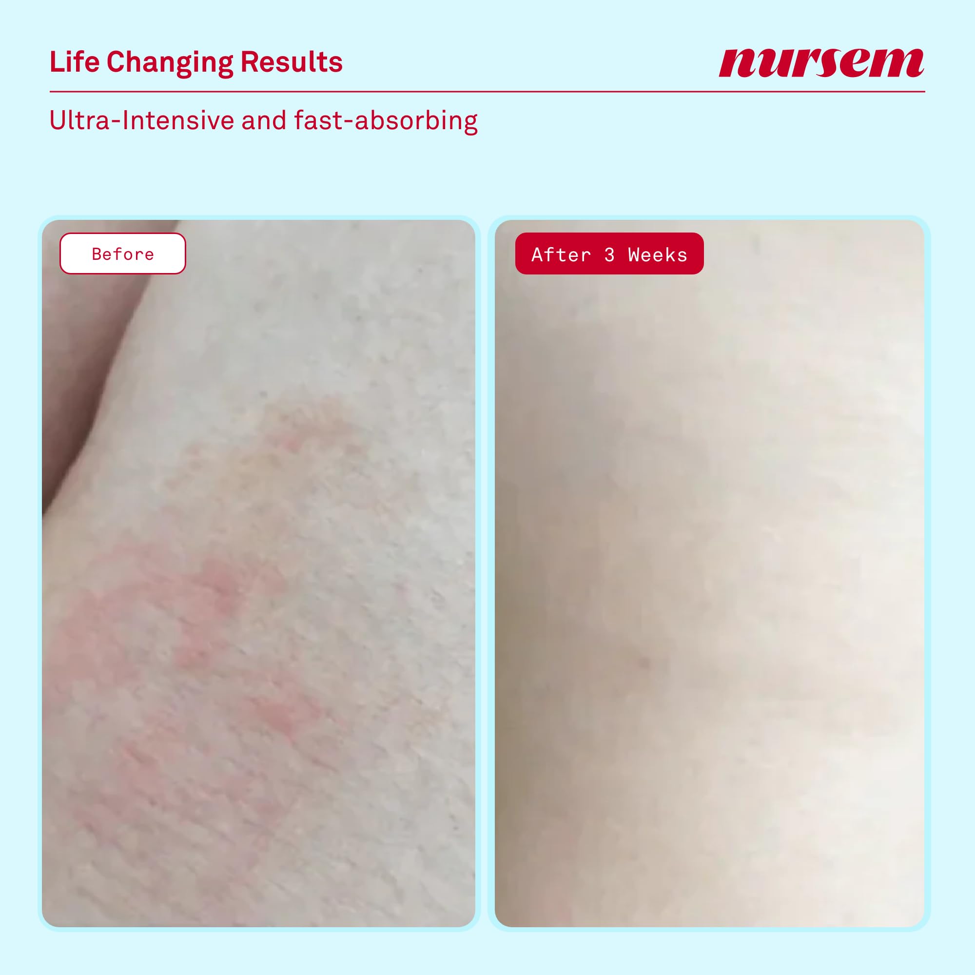Nursem Ultra Caring Body Balm 250ml