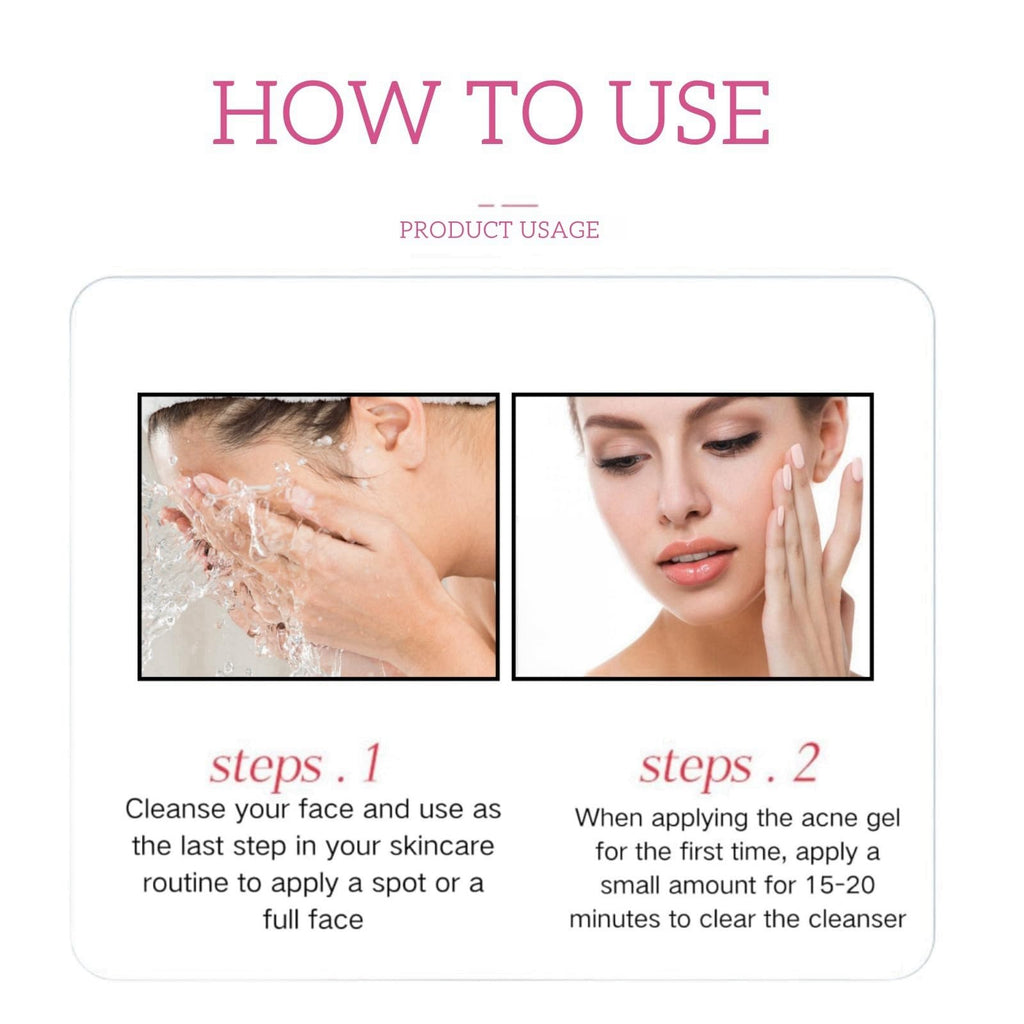 Azelaic Acid 15% Acne Tratment Gel,Azelaic Acid Serum Cream with Niacinamide & Vitamin C,Anti Acne Gel for Spot Prone Skin,Face Serum for Women,Hydrating Serum,Moisturiser Face,Serums Skincare