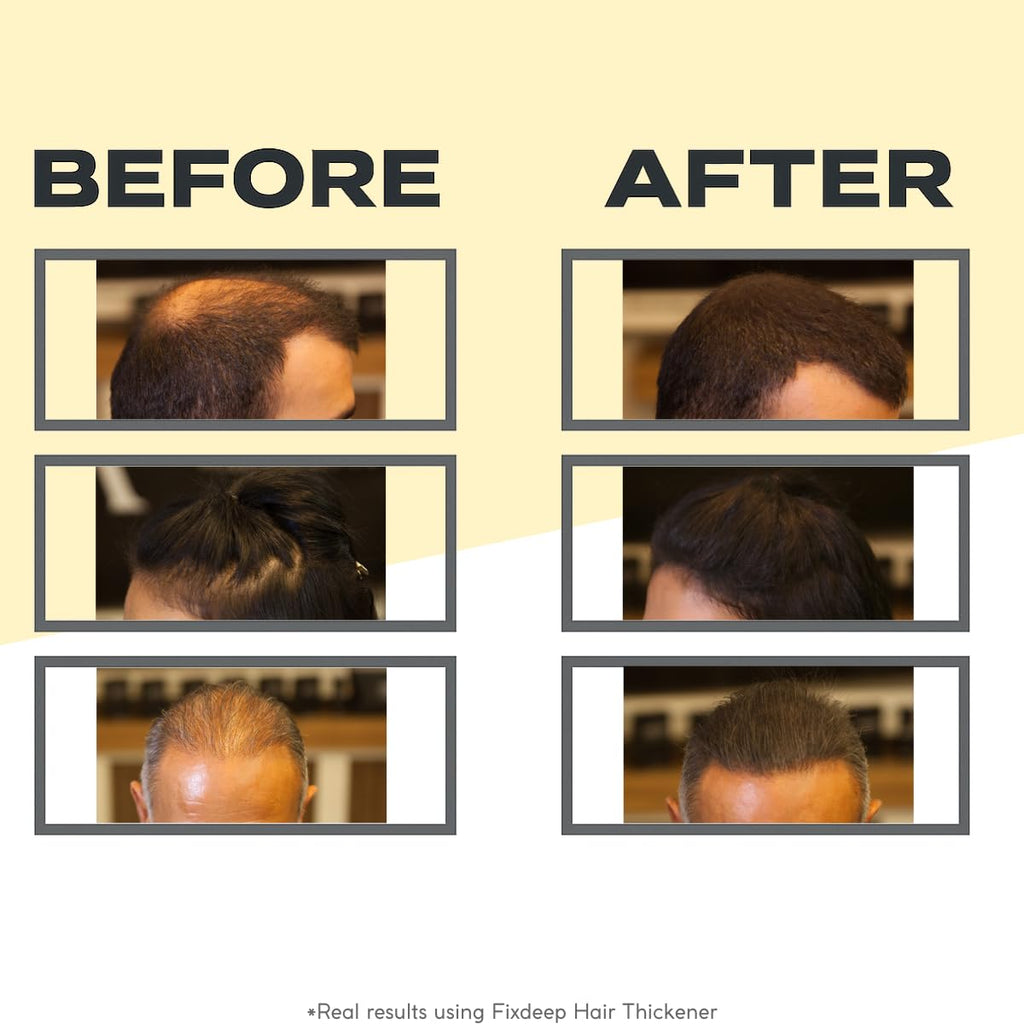 FIXDEEP Hair Thickener | New Waterproof Formula - Natural & Fuller Appearance in 30 Seconds - 14g - Hair Fibers for Thinning Hair, Bald Spots & Graying Roots (Medium Brown)