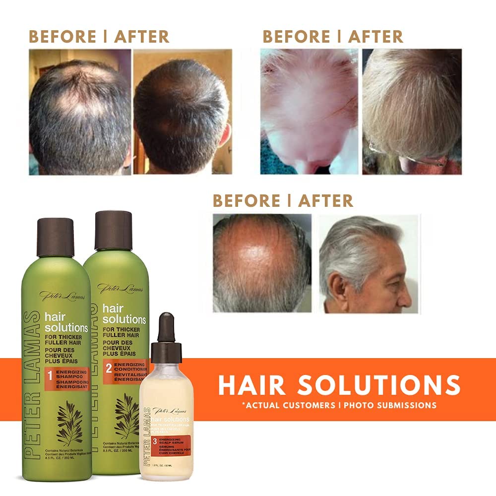 Peter Lamas Biotin Regrowth Conditioner | Apple Stem Cell, Vitamin B, Aloe, and Natural Botanicals Combine to Support Thicker, Fuller Hair | Reduce Scalp Irritation, Itching, and Flaking (Pack of 2)