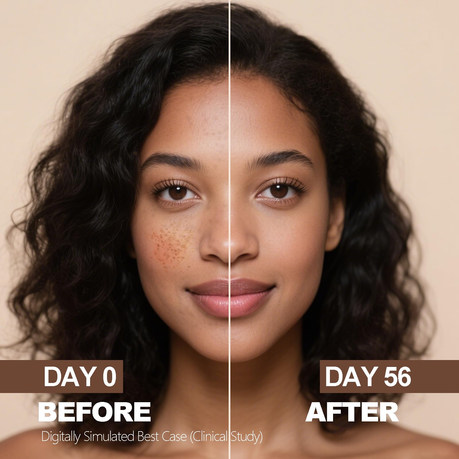aobenz Dark Spot Remover for Face with 3% Tranexamic Acid + 2% Niacinamide + Alpha-Arbutin, Brightening Serum for Age Melasma Sun Black Spots, Target Hyperpigmentation, Results in 2-4 Weeks