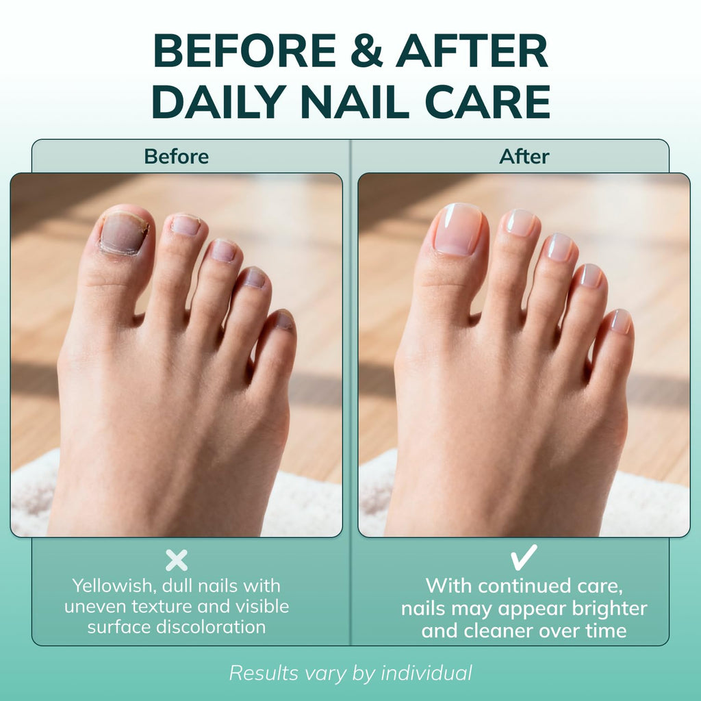 Swissklip Medi-Care Toenail Stick I KlearNail Treatment | Natural Solution for Healthy Nails I Suitable For Foot, Toe, and Fingernail I For Brittle Toenails – 10ml / 0.3 Fl. Oz. Pack 2 - Made in USA