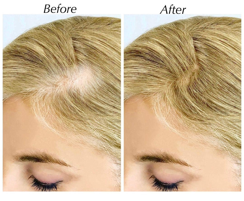 SALON IN A BOTTLE Powder - Root Touch Up, Instantly Covers Gray Roots and Thinning Hair, Dark Blonde