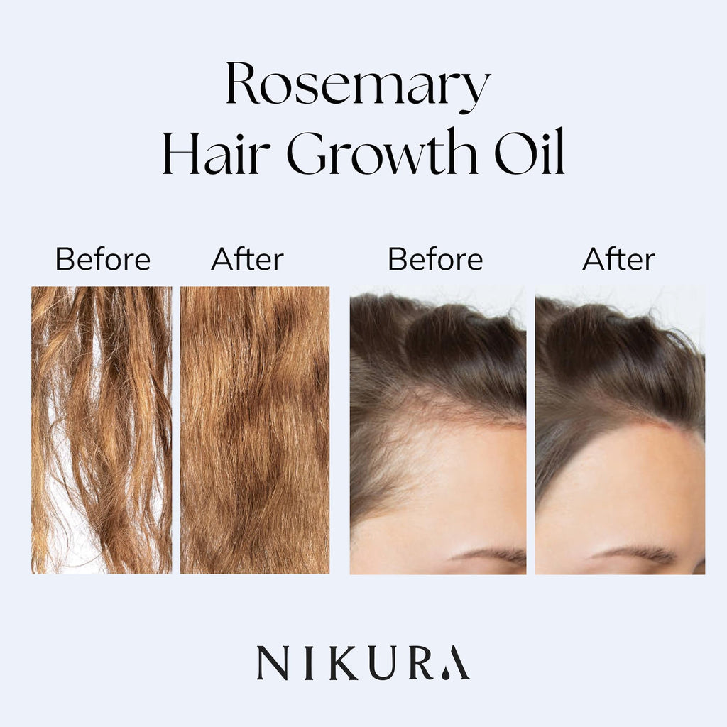 Nikura Rosemary Oil for Hair Growth & Skin Care - 250ml | Hair Oils for Hair Growth, Skin Serum, Beard Growth | Treatment Oil with Almond, Jojoba, Argan Oil & Rosemary Oil | UK Made & BPA Free