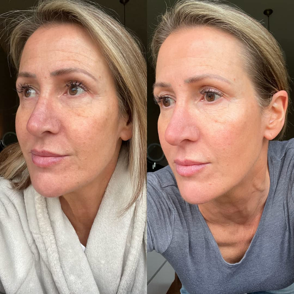 Skinny Tan Notox Retinol Dream Serum 50ml | Overnight Renewal Serum | Gradual Bronzed Glow | Gradual Face Tanner | Anti-Ageing Skincare with 1% Retinol