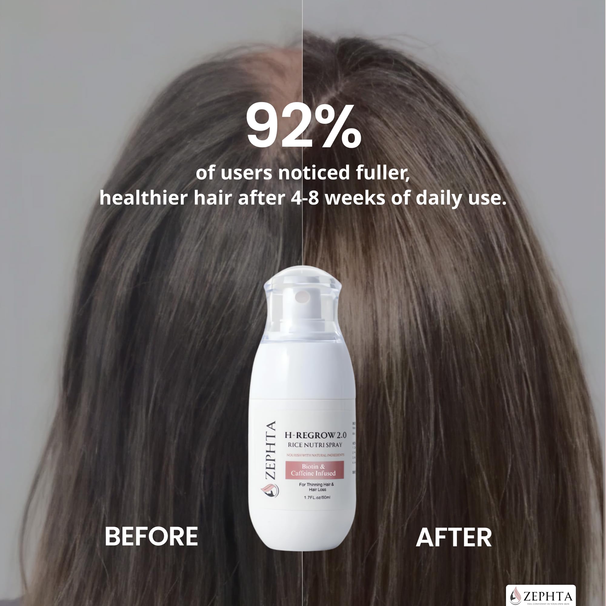 Zephta H-Regrow Hair Growth Spray – With Rice Water, Biotin, Aloe Vera, Caffeine, and Ginger – Hair Growth Product for Men and Women – For Thinning Scalp