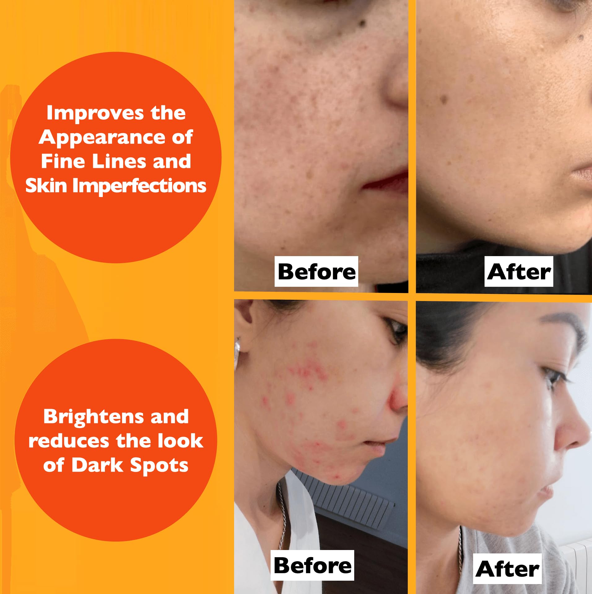 Vitamin C Serum For Face – Anti Aging Face Serum with Vitamin C, Hyaluronic Acid, Vitamin E. Brightening Formula. Improve Appearance of Dark Spots, Tone, Fine Lines & Wrinkles, Glowing Skin 2 Fl Oz