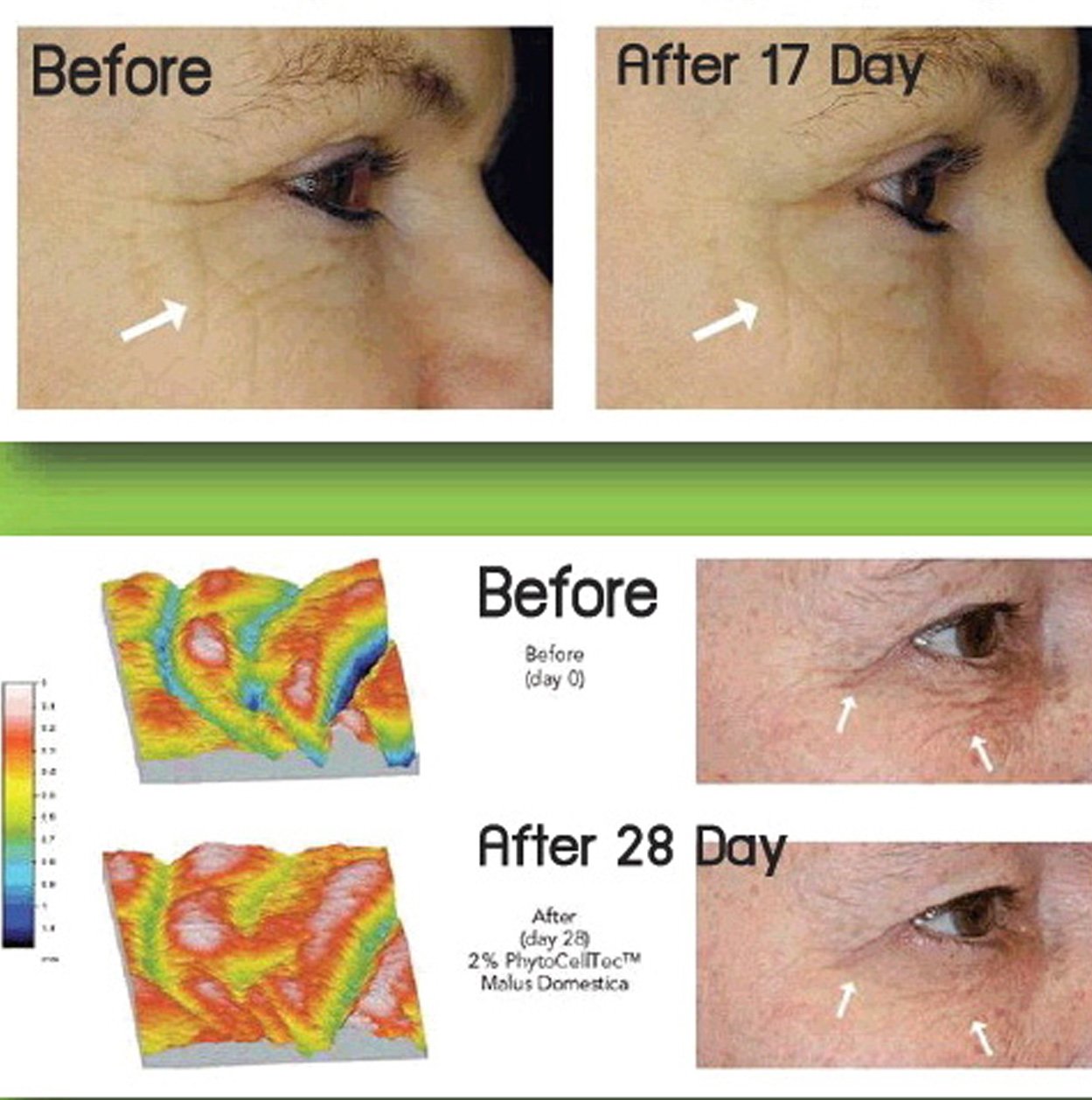 Anti-Aging. DIY Swiss Apple Stem Cell 100% Serum Booster. Remove Wrinkles, Rebuild Collagen & Elastin