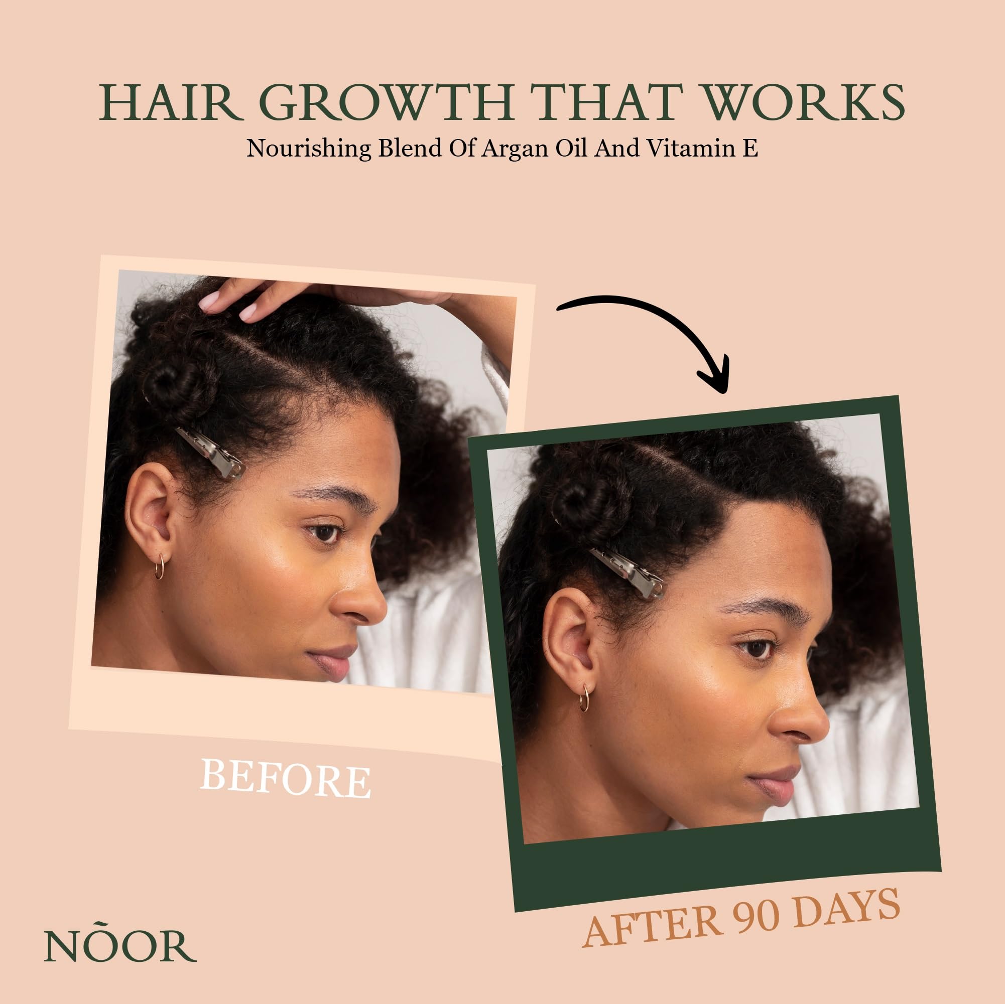 NOOR HAIR Growth Serum From African Olives, for Women and Hair Loss Treatment for Frizzy and Damaged, For Thicker and Healthier- Natural Vitamins Argan Oil