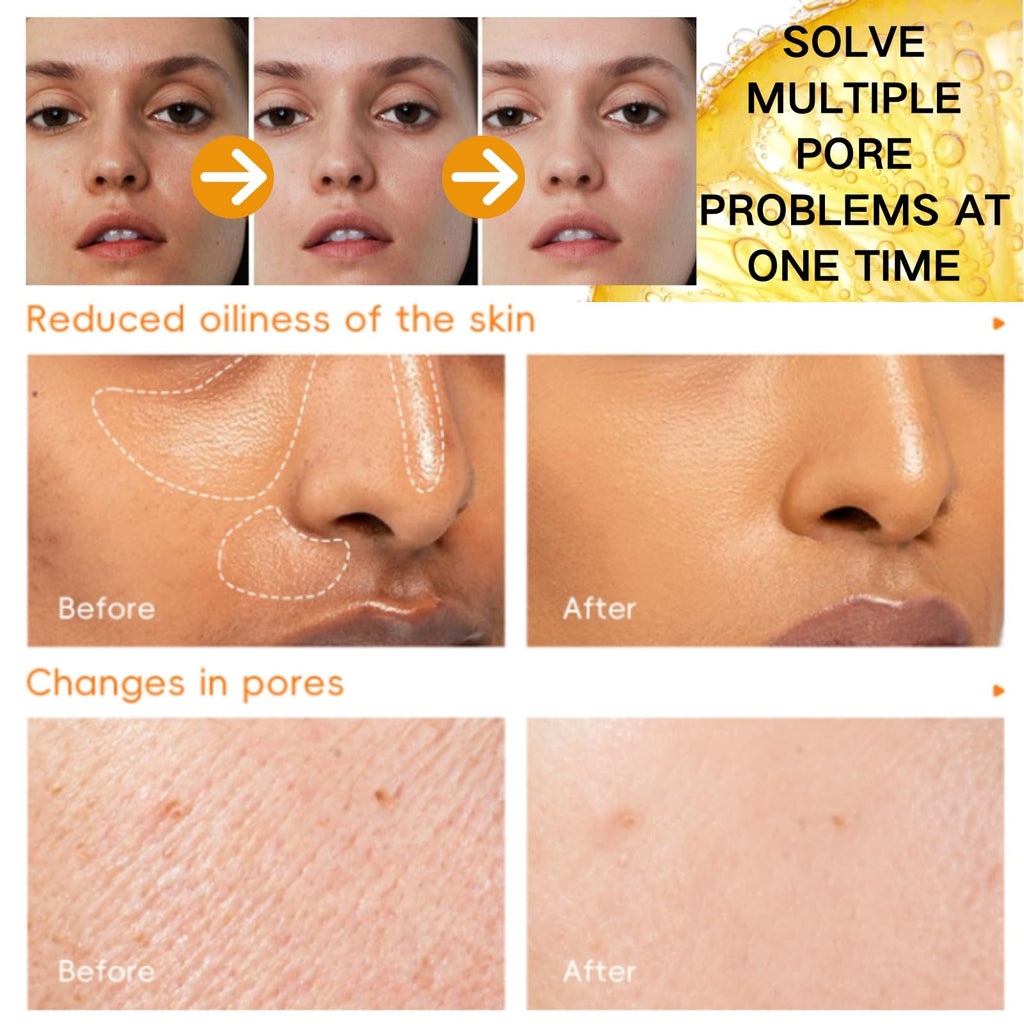 Vitamin C Eye Cream Stick - Vitamin V Serum Stick - Vitamin C Serum for Face Korean - Dark Spot Remover - Brightening Serums for Women - Reduce Fine Lines & Wrinkles