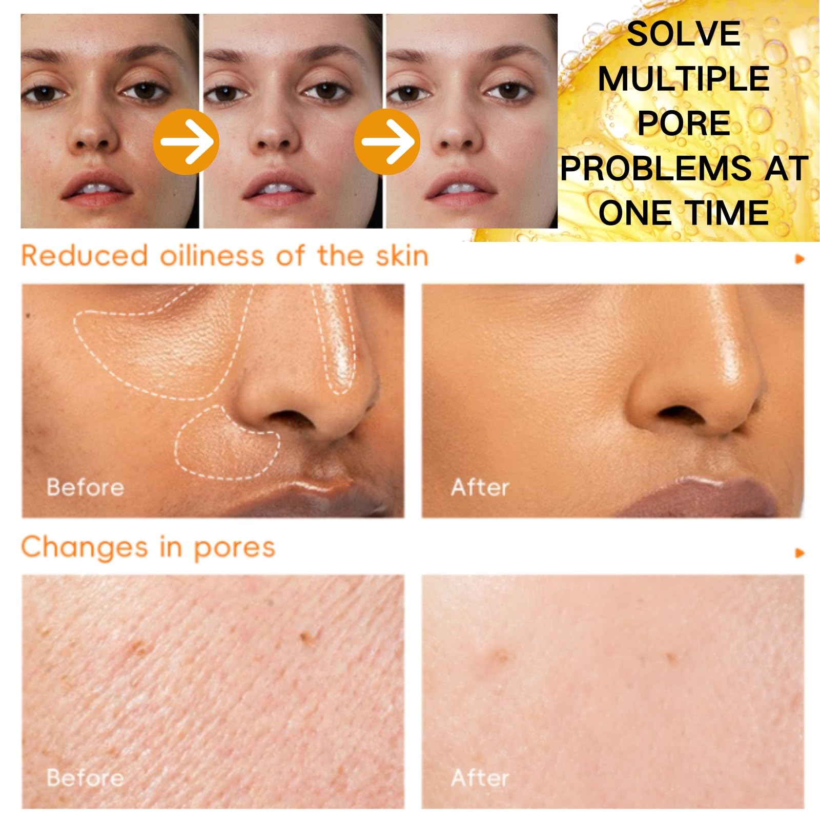Vitamin C Eye Cream Stick - Vitamin V Serum Stick - Vitamin C Serum for Face Korean - Dark Spot Remover - Brightening Serums for Women - Reduce Fine Lines & Wrinkles