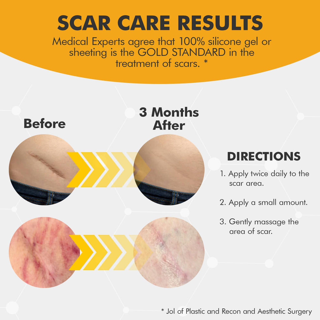 DermAvance Pure Scar Care "Medical Grade Silicone Gel" for Surgical and Facial Marks - Silicone Cream for Effective Scar Management - 1.05822 fl oz (30g), Clear