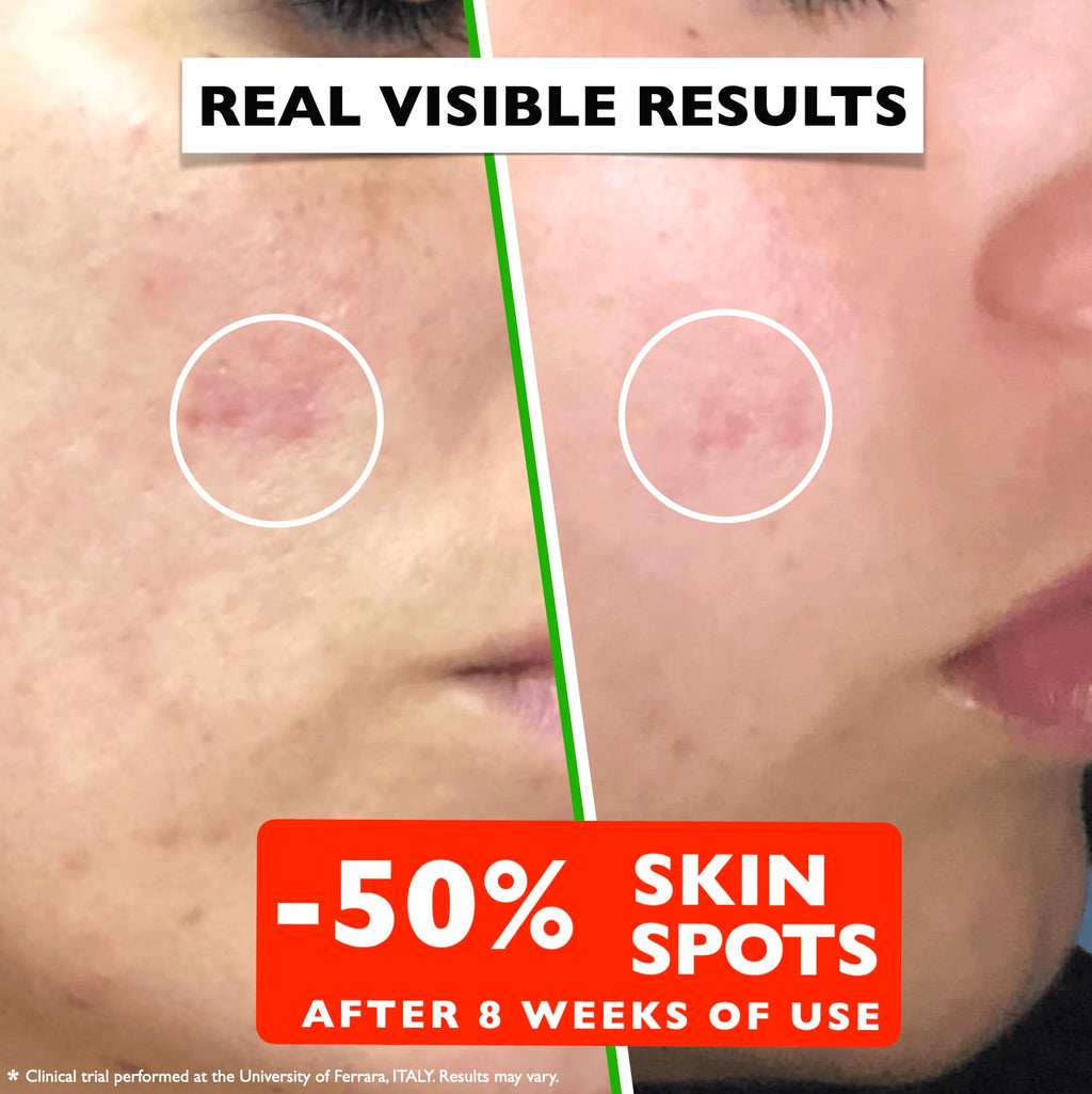 Vitamin C Serum For Face – Anti Aging Face Serum with Vitamin C, Hyaluronic Acid, Vitamin E. Brightening Formula. Improve Appearance of Dark Spots, Tone, Fine Lines & Wrinkles, Glowing Skin 2 Fl Oz