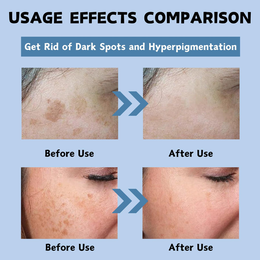 Dark Spot Cream, Tranexamic Acid & Niacinamide Face Cream for Women, Anti Aging Face Cream for Freckles & Dark Spot Remover for Even Skin Tone, Moisturiser Face Women & Men, 50ml