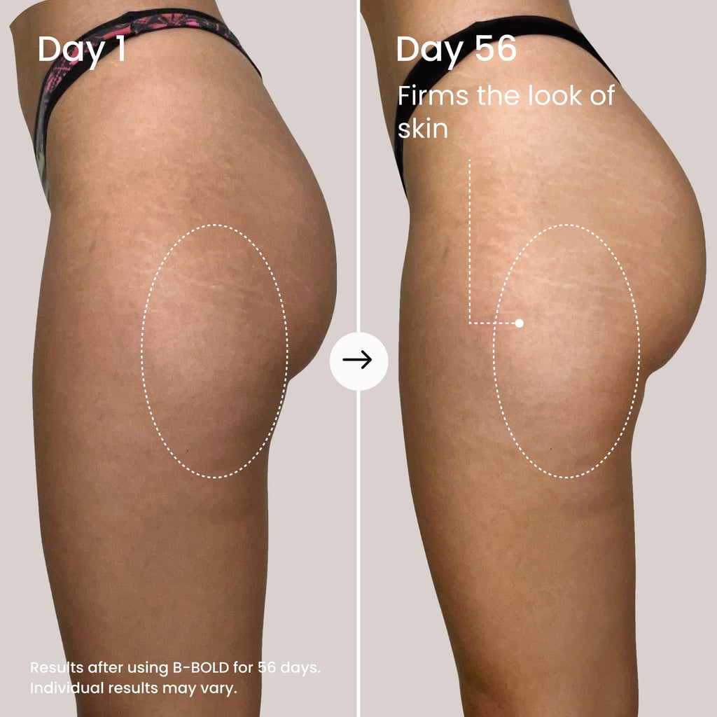 MAËLYS B-BOLD Booty Enhancing Mask - Plumping & Firming Body Cream for Booty Area - Skin Tightening With Hydrating Hyaluronic Acid & Grape Seed Oil (3.38 Fl Oz)