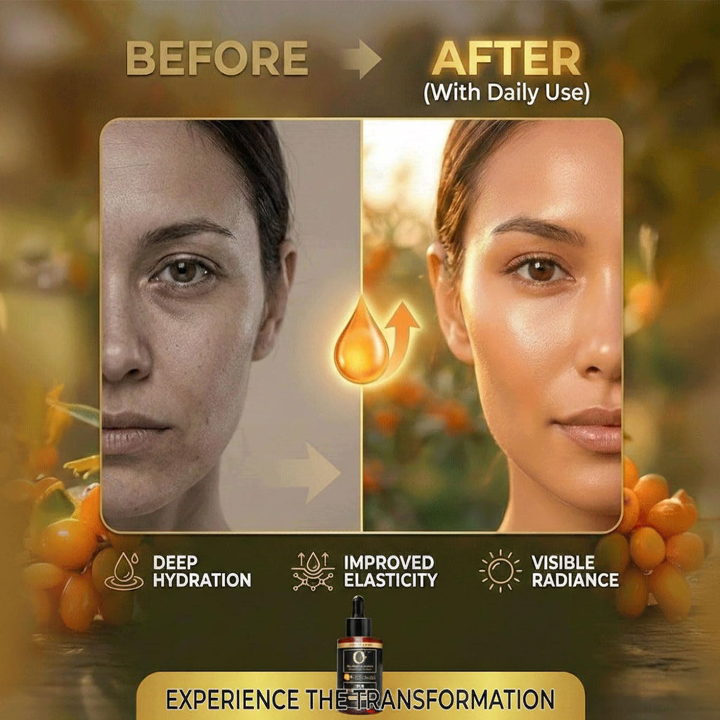 Organic Sea Buckthorn Oil Cold Pressed - 100% Pure Seabuckthorn Oil for Face, Skin & Hair | Anti-Aging, Acne & Dry Skin Care
