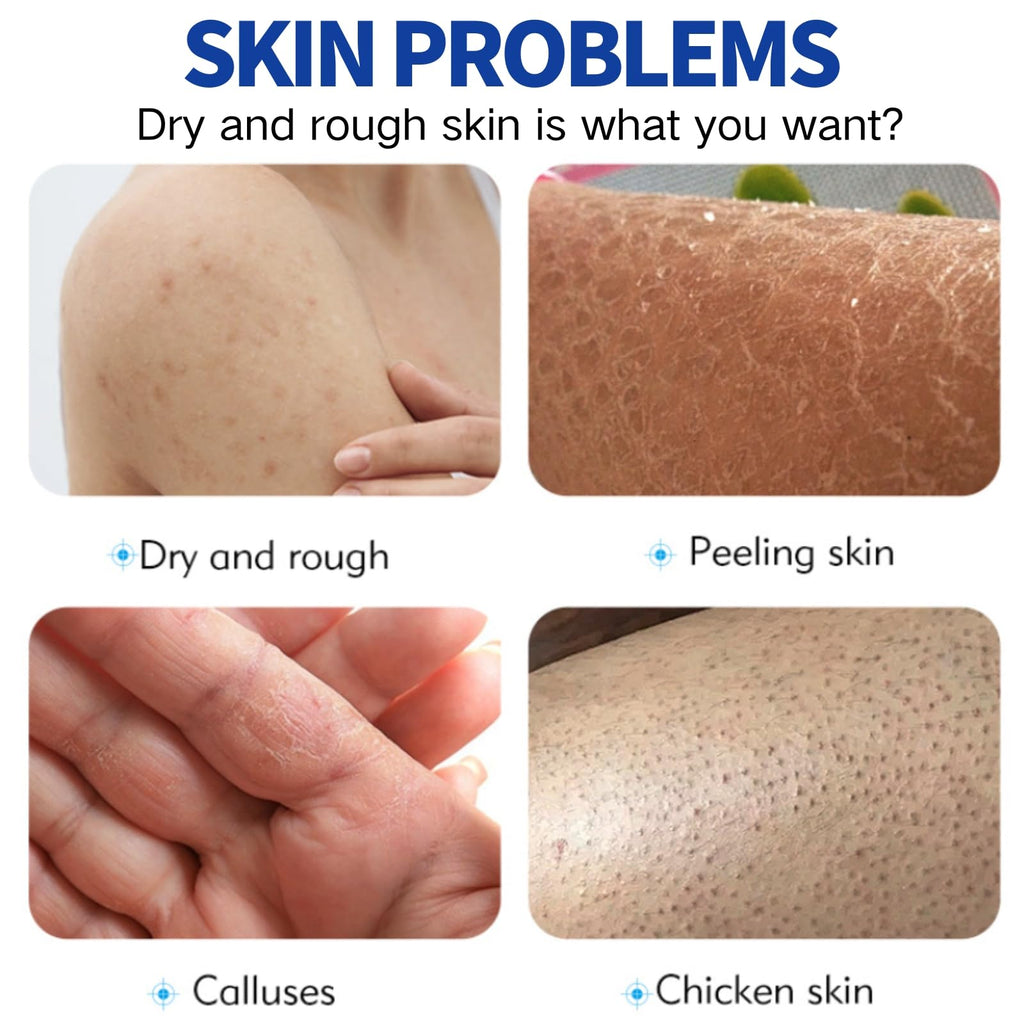 100ml 60% Urea Cream - Cracked Heel Repair Cream For Feet and Hand - Foot Cream for Cracked Heels and Dry Skin - Urea Creams 60 Percent for Feet