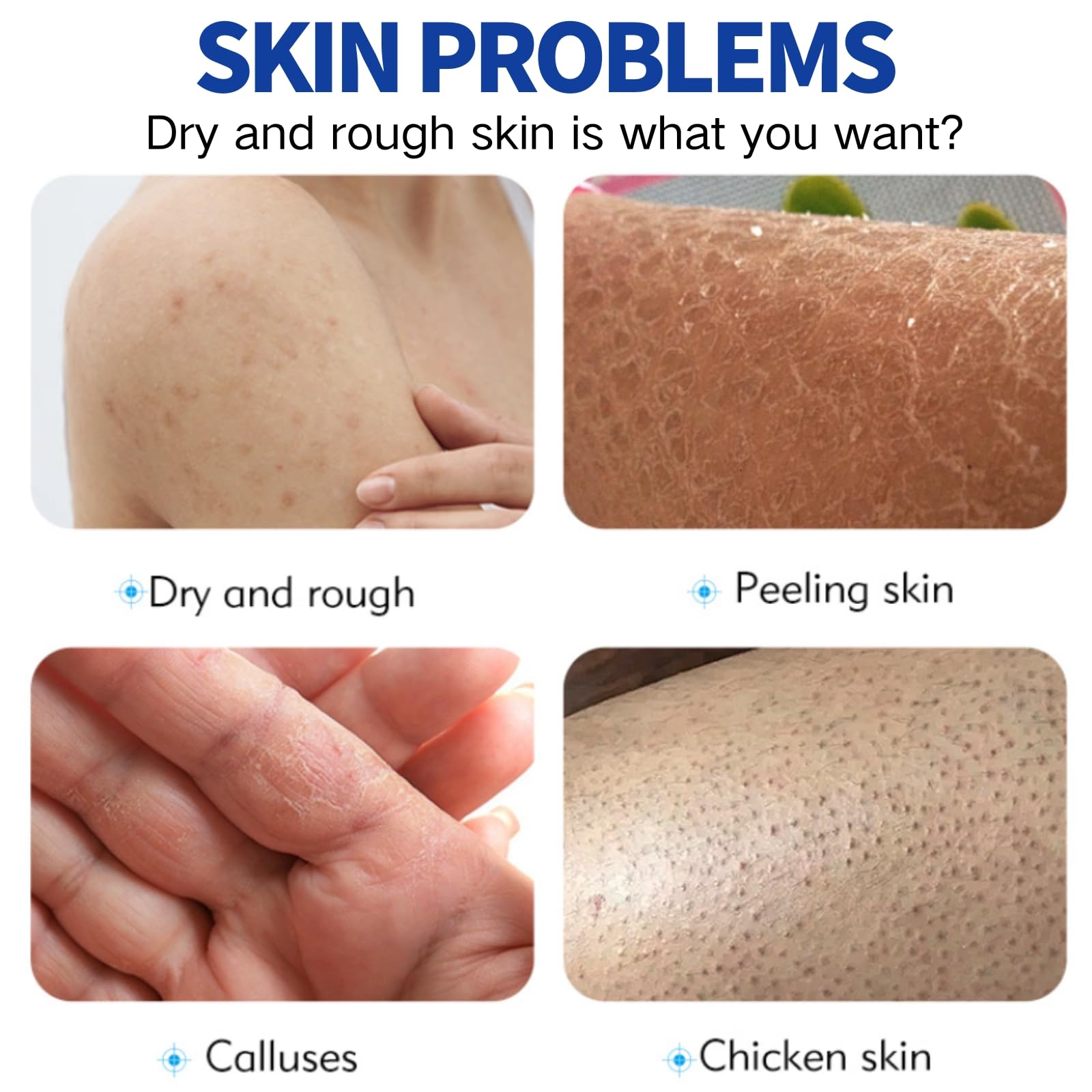 100ml 60% Urea Cream - Cracked Heel Repair Cream For Feet and Hand - Foot Cream for Cracked Heels and Dry Skin - Urea Creams 60 Percent for Feet