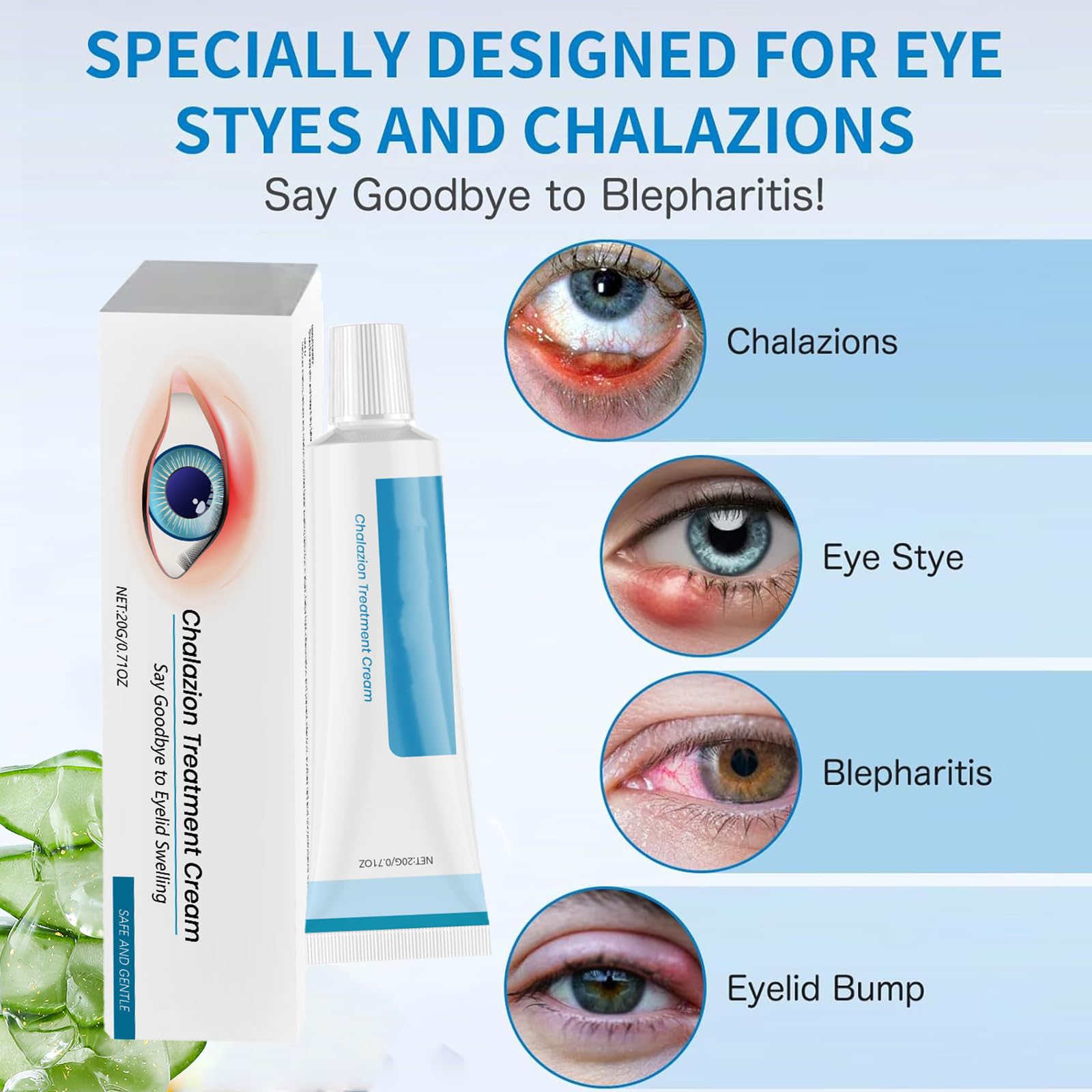 2PCS Chalazion & Blepharitis Treatment Eye Cream, Chalazion Eye Treatment, Eyelid Cream for Blepharitis, Stye Treatment for Dry Eyes, Moisturizing Eyelid Cream for Daily Eye Care, Soothe, Hydrate