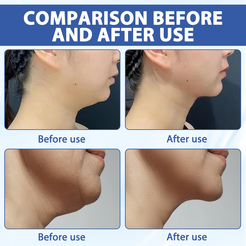 3 Pieces Chinology Double Chin Lifting Mask, Chin Lift Mask, Moisturizes and Tightens the Skin, the Texture Is Light and Fits the Skin, and Changes the Jawline