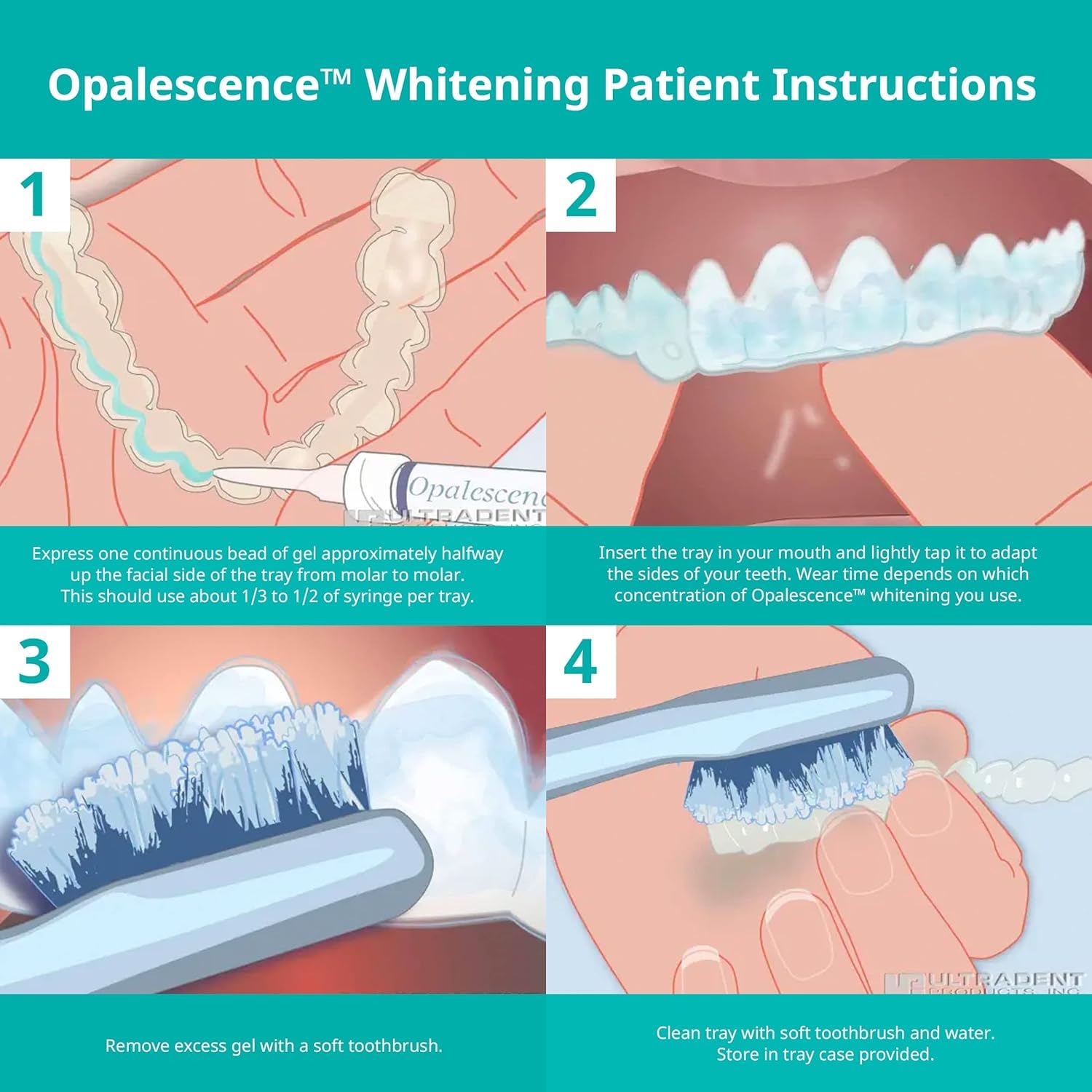 Opalescence 35% CP Mint - Gel Syringes Teeth Whitening - Refill Kit - Carbamide Peroxide Gel. Made by Ultradent. Tooth Whitening Refill Syringes 5197 (0.04 Fl Oz (Pack of 4))
