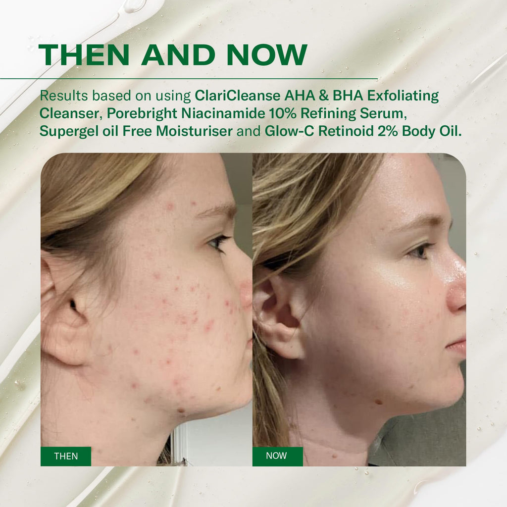 facetheory Supergel+ Oil-Free Moisturiser with niacinamide and prebiotics