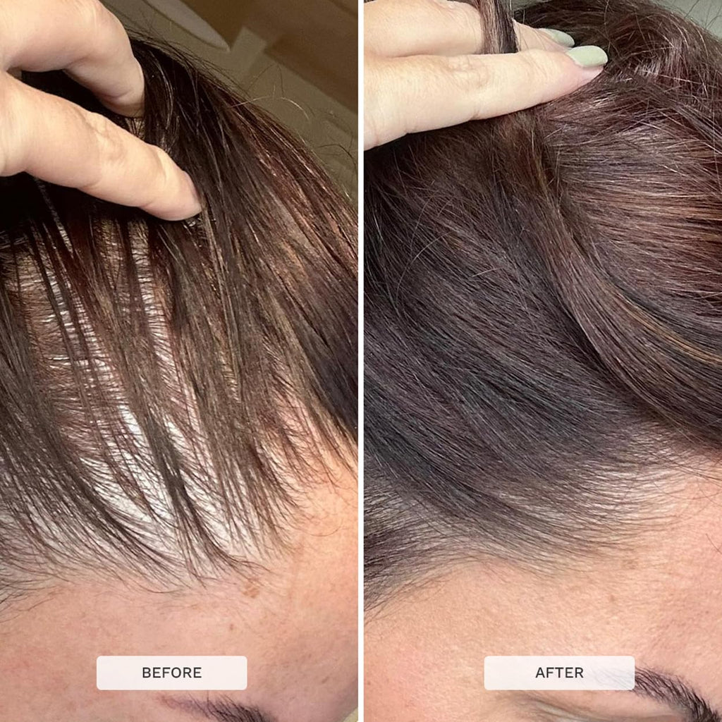 HAIR BURST Hair Growth Biotin Gummies - Daily Vitamins - 30 Day Supply