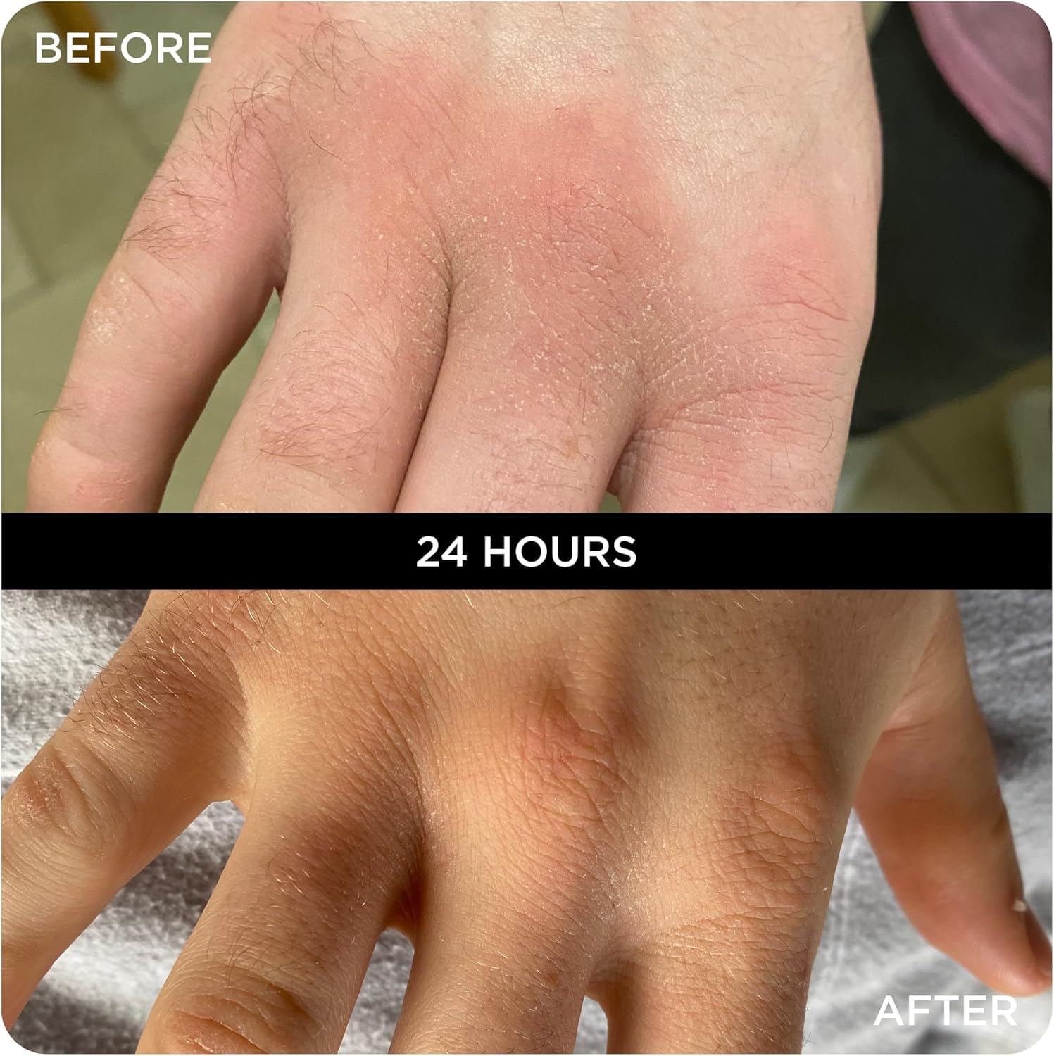 WONDERBALM Multi Use Balm All Purpose Skin Moisturising Cream for Face Body Hair Lips & Cuticles Hydrating Fast Absorbing Vegan Natural Skincare Korean Beauty Multi Award Winning British Brand (50ml)